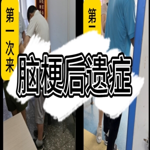  伊川城西医院：脑梗后遗症 康复案例